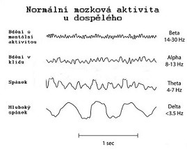 eeg-0-1-0.jpg