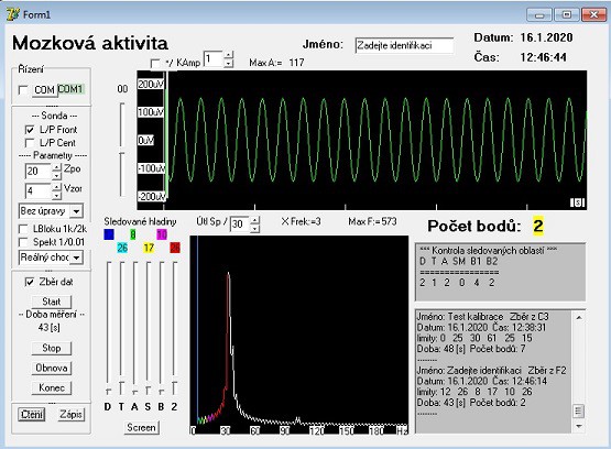 eeg-0-4.jpg
